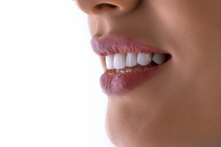 estetica dental