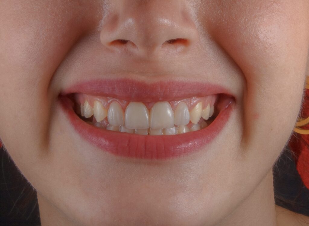 clinica dental barrio del pilar
