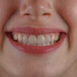 clinica dental barrio del pilar