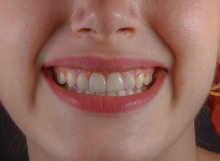 clinica dental barrio del pilar