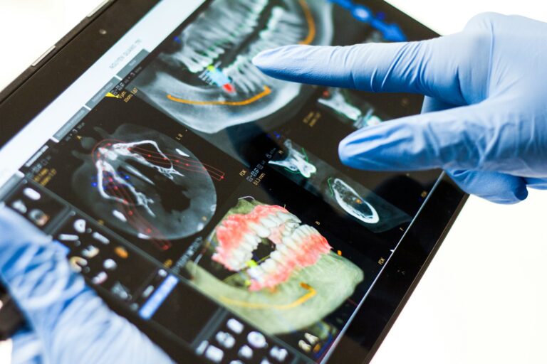implantes dentales