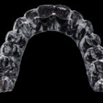 invisalign
