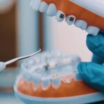 clínica dental barrio del pilar