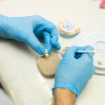 implante dental